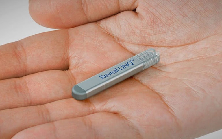 implantable loop recorder on the plm of a hand